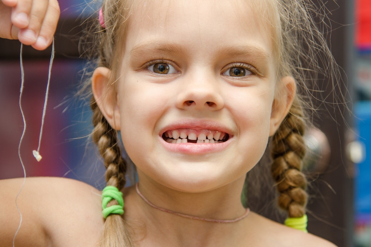 Criança segurando uma linha com o dente amarrado na ponta que acaba de ser arrancado de sua boca - foto: Madhourses/ShutterStock.com