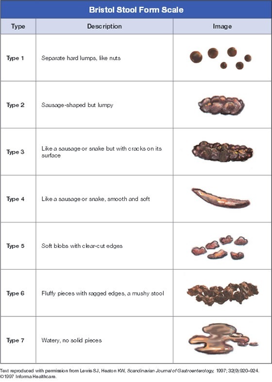 Escala de aparência do cocô (fezes) - bowelcontrol.nih.gov