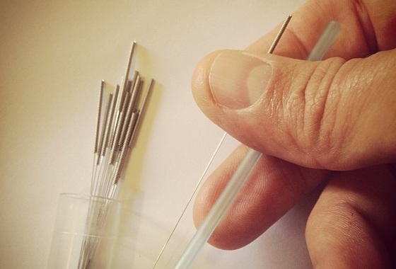 acupuntura na gestação e parto - Foto: Victor / flickr