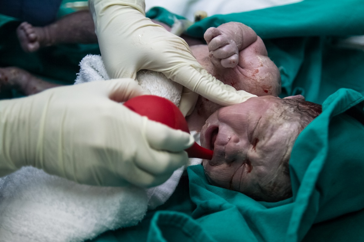 Médico aspirando secreções do bebê recém-nascido - foto: BaddocShutter/ShutterStock.com