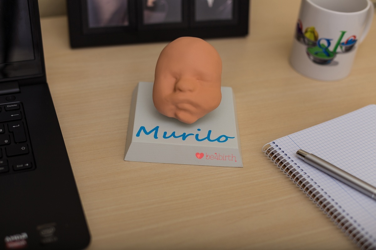 Impressão 3D do rosto de um feto - Be4Birth