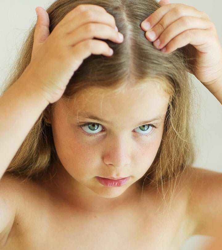 Queda capilar infantil tratamento é fundamental para evitar danos no psicológico das crianças