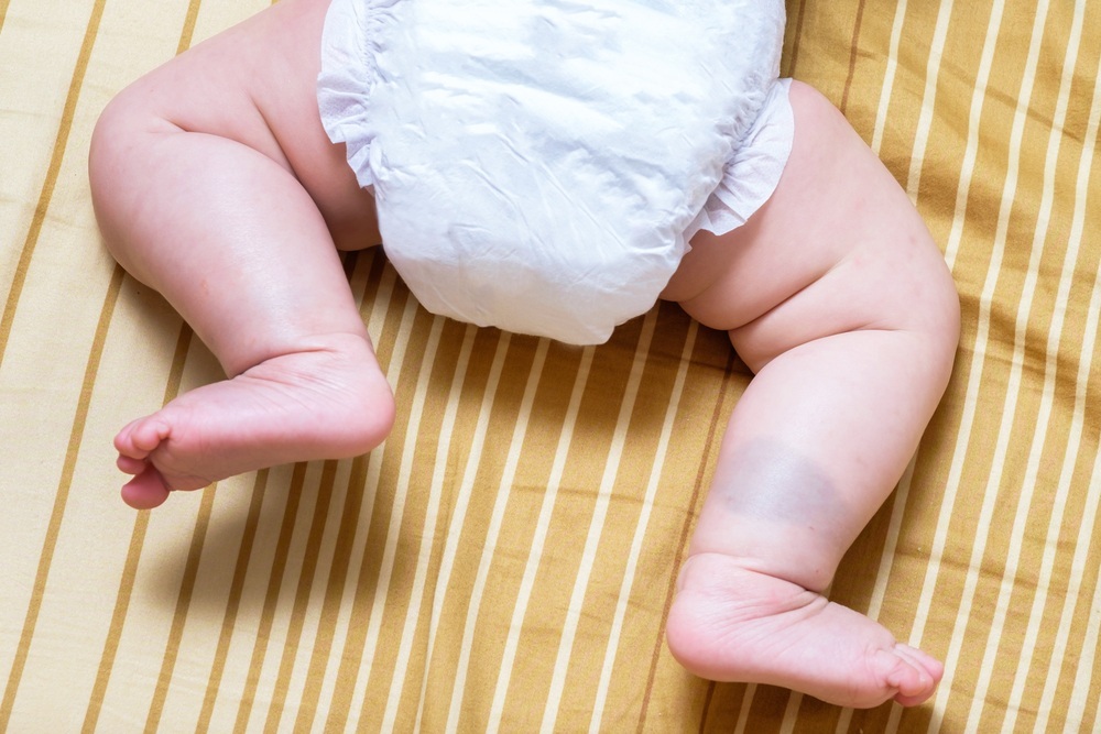 Bebê da cintura para baixo usando fraldas - foto: Yoottana Tiyaworanan/ShutterStock.com Bebê da cintura para baixo usando fraldas - foto: Yoottana Tiyaworanan/ShutterStock.com
