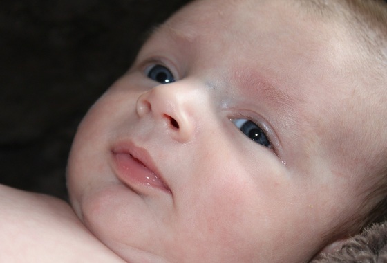 Lacrimejamento excessivo em bebês pode ser sinal de obstrução do canal lacrimal - Foto: TaniaVdB / pixabay.com Lacrimejamento excessivo em bebês pode ser sinal de obstrução do canal lacrimal - Foto: TaniaVdB / pixabay.com