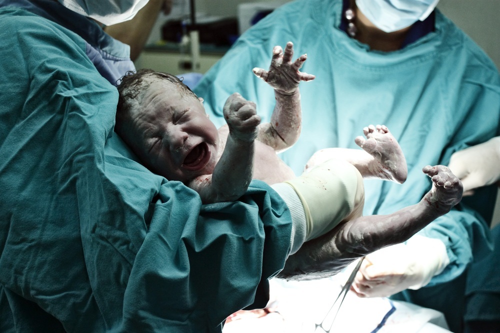 Bebê recém-nascido logo após o parto - Foto: Reynardt/ShutterStock