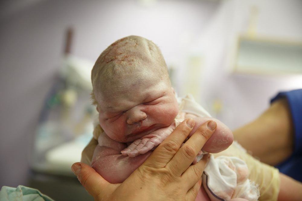 Bebê recém-nascido imediatamente após o parto - foto: zlikovec/ShutterStock.com Bebê recém-nascido imediatamente após o parto - foto: zlikovec/ShutterStock.com