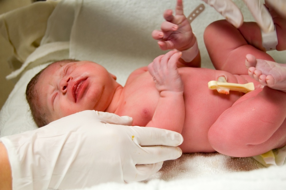 Recém-nascido na sala de parto sendo examinado pelo médico - Teste de Apgar - foto: Brian McEntire/ShutterStock.com